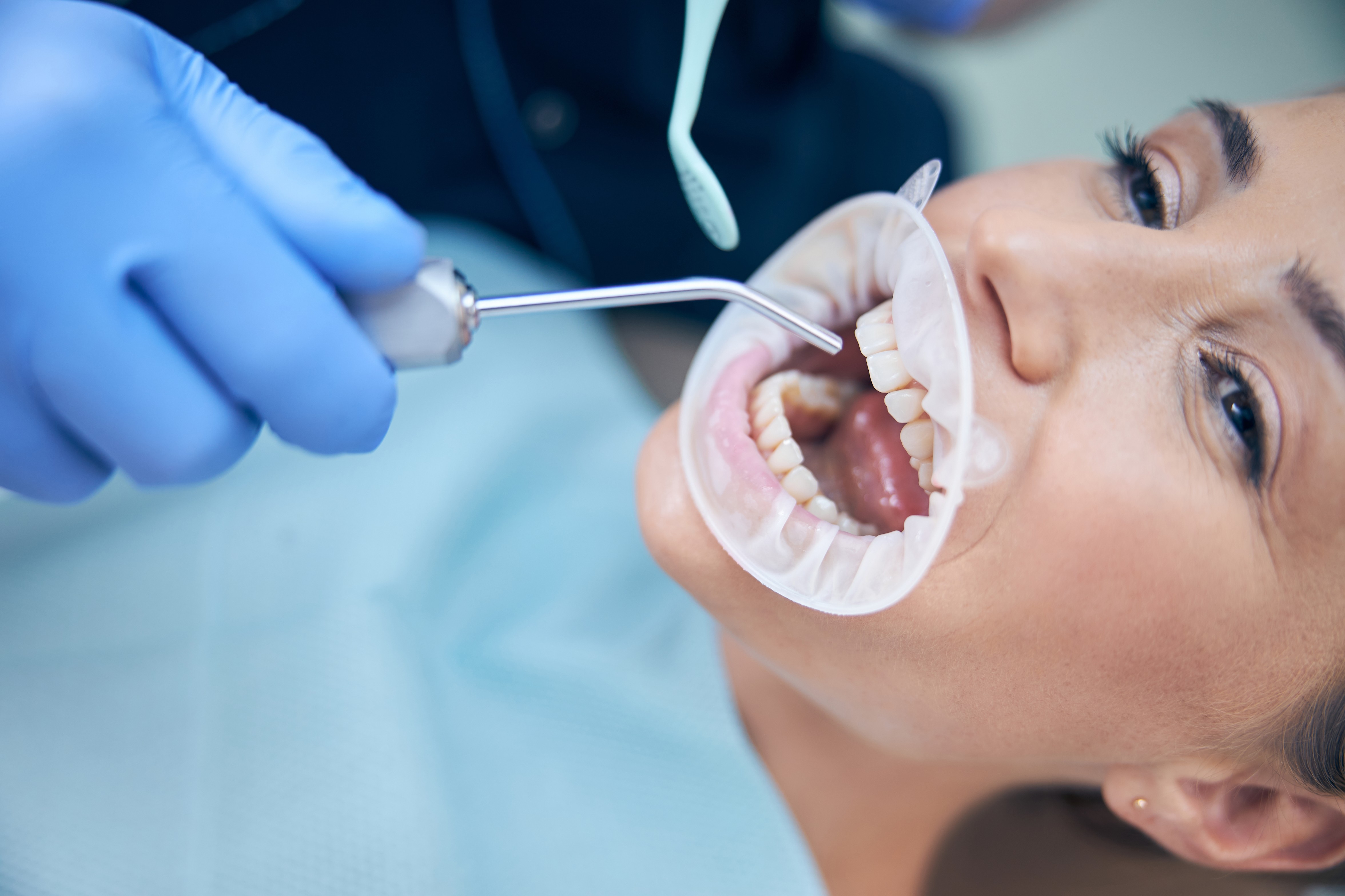 Invisible Fillings